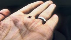 В Оренбуржье зафиксирован случай заболевания клещевым энцефалитом